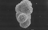 Image result for "dentagloborotalia Anfracta". Size: 161 x 100. Source: www.mikrotax.org