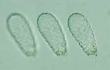 Image result for "parilia Tuberculata". Size: 158 x 101. Source: protist.i.hosei.ac.jp