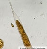 Image result for "Helicostomella subulata". Size: 98 x 101. Source: images.cnrs.fr
