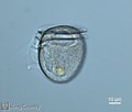 Image result for "dinophysis Rotundata". Size: 120 x 102. Source: green2.kingcounty.gov
