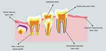 Dental Pulp Stem Cell markers కోసం చిత్ర ఫలితం. పరిమాణం: 211 x 102. మూలం: www.wjgnet.com