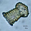 Image result for "codonella Perforata". Size: 100 x 102. Source: cfb.unh.edu