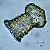 Afbeeldingsresultaten voor "codonella Perforata". Grootte: 102 x 102. Bron: cfb.unh.edu