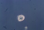 Image result for "dinophysis Rotundata". Size: 149 x 102. Source: www.soundtoxins.org