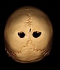 Bildergebnis für Foramen parietale Permagnum. Größe: 87 x 102. Quelle: in.pinterest.com