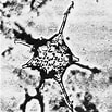Afbeeldingsresultaten voor "acrosphaera Spinosa". Grootte: 103 x 103. Bron: www.mikrotax.org
