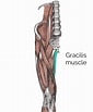 Image result for Musculus Gracilis. Size: 85 x 103. Source: geekymedics.com