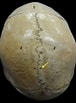 Image result for Foramina parietalia Anatomie. Size: 76 x 103. Source: ar.inspiredpencil.com