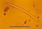 Image result for "clathria Atrasanguinea". Size: 148 x 103. Source: doris.ffessm.fr