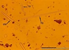 Image result for "clathria Atrasanguinea". Size: 143 x 103. Source: doris.ffessm.fr