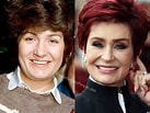 Image result for Sharon Osbourne Before Surgery. Size: 137 x 103. Source: www.plasticsurgerypeople.com