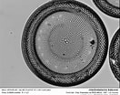 Image result for "discoconchoecia Elegans". Size: 132 x 104. Source: forum.mikroscopia.com