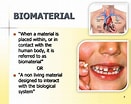 in vitro models for Biocompatibility of Dental Materials के लिए छवि परिणाम. आकार: 131 x 104. स्रोत: www.slideserve.com