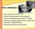 Image result for Uterus Didelphys. Size: 123 x 104. Source: www.slideserve.com