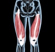 Image result for "palapedia Quadriceps". Size: 110 x 104. Source: athleteschoicemassage.ca