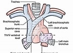 Image result for "caecum Trachea". Size: 144 x 104. Source: www.earthslab.com