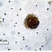 Image result for "strobilidium Typicum". Size: 105 x 104. Source: www.researchgate.net