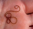 Afbeeldingsresultaten voor Rode draadworm. Grootte: 119 x 104. Bron: qsota.com