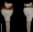 Afbeeldingsresultaten voor "teredora Malleolus". Grootte: 106 x 104. Bron: www.researchgate.net