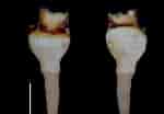 Image result for "teredora Malleolus". Size: 150 x 104. Source: www.researchgate.net