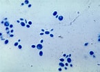 Image result for "Protocystis Swirei". Size: 145 x 104. Source: www.publicdomainfiles.com