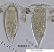 Image result for "strobilidium Typicum". Size: 107 x 104. Source: web.nies.go.jp