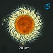 Image result for "strobilidium Typicum". Size: 104 x 104. Source: planktonnet.awi.de