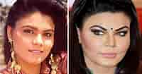 Rakhi Sawant Before and After Surgery-साठीचा प्रतिमा निकाल. आकार: 200 x 105. स्रोत: www.indiatimes.com