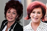 Image result for Sharon Osbourne Before Surgery. Size: 158 x 105. Source: javaui.aussievitamin.com