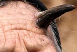 Image result for "cutaneous Horns". Size: 157 x 105. Source: allthatsinteresting.com