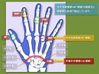 MCP関節 に対する画像結果.サイズ: 140 x 105。ソース: www.jusei-news.com