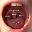 Biletresultat for normal Tonsil Strep Throat. Storleik: 106 x 105. Kjelde: ent4kids.nz