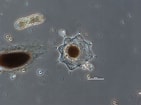 Afbeeldingsresultaten voor "acanthometra Cylindrica". Grootte: 141 x 105. Bron: plankton.mio.osupytheas.fr