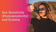 Image result for Photosensitivity to the Sun. Size: 183 x 105. Source: www.myeczemateam.com