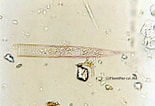 Afbeeldingsresultaten voor "Helicostomella subulata". Grootte: 155 x 106. Bron: biodic07.blog97.fc2.com