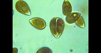Image result for "ostreopsis Labens". Size: 202 x 106. Source: www.youtube.com