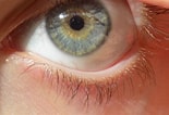 Image result for "heterochromia Fragilis". Size: 155 x 106. Source: www.pinterest.co.uk