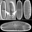 Image result for "sudis Hyalina". Size: 107 x 106. Source: diatoms.org