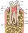 Tooth Pulp cavity ಗಾಗಿ ಇಮೇಜ್ ಫಲಿತಾಂಶ. ಗಾತ್ರ: 92 x 106. ಮೂಲ: pocketdentistry.com