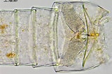 Afbeeldingsresultaten voor "paracalanus Aculeatus". Grootte: 159 x 106. Bron: plankton.image.coocan.jp