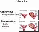 Bildergebnis für Uterus Didelphys. Größe: 130 x 106. Quelle: www.semanticscholar.org