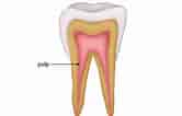Tooth Pulp cavity ಗಾಗಿ ಇಮೇಜ್ ಫಲಿತಾಂಶ. ಗಾತ್ರ: 166 x 106. ಮೂಲ: mammothmemory.net