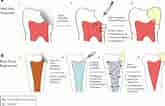 Image result for Cell Lines in Dental pulp. Size: 165 x 106. Source: www.frontiersin.org