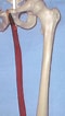 Afbeeldingsresultaten voor "tortanus Gracilis". Grootte: 60 x 106. Bron: www.webmanmed.com