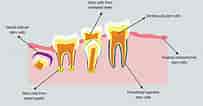 Image result for Dental Pulp cells. Size: 203 x 106. Source: www.wjgnet.com