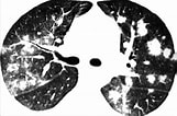 Image result for "pneumodermopsis Minuta". Size: 161 x 106. Source: www.researchgate.net