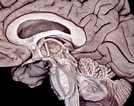 Image result for "clathrina Cerebrum". Size: 134 x 106. Source: www.neurosurgicalatlas.com