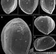 "ostreopsis Lenticularis" に対する画像結果.サイズ: 111 x 106。ソース: www.researchgate.net