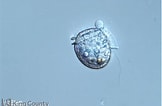 Image result for "dinophysis Rotundata". Size: 162 x 106. Source: green2.kingcounty.gov