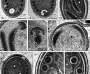 Image result for "thecosphaera Inermis". Size: 129 x 106. Source: www.researchgate.net